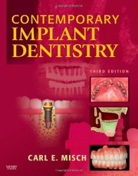 Contemporary Implant Dentistry, 3e