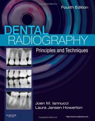 Dental Radiography: Principles and Techniques, 4e