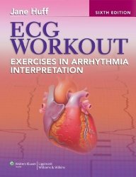 ECG Workout: Exercises in Arrhythmia Interpretation (Huff, ECG Workout)