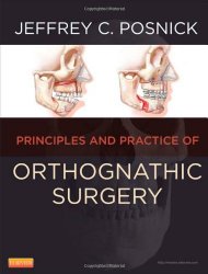 Orthognathic Surgery – 2 Volume Set: Principles and Practice, 1e