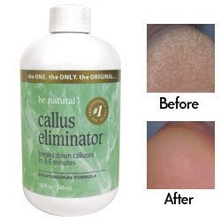 ProLinc Callus Eliminator – 4 oz