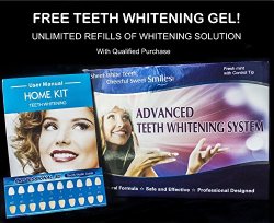Advanced Teeth Whitening Kit with Unlimited Free Refills – Best Teeth Whitening at Home – Order Now RISK FREE