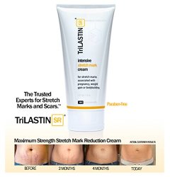NEW! TriLASTIN-SR Intensive Stretch Mark Cream – 5.5oz
