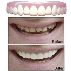 Imako Cosmetic Upper Teeth 1 Pack (Small, Natural)