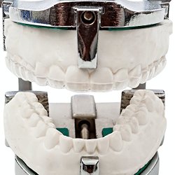 J&S Dental Lab Custom Night Guard for Teeth Grinding, Bruxism, TMJ – Bite Guard, Mouth Guard – Upper